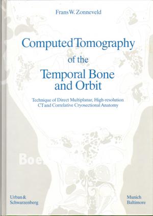 Computed Tomography of the Tempral Bone and Orbit